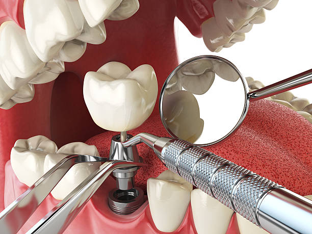 Best Knocked-Out Tooth Emergency  in Barberton, OH